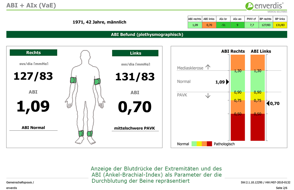 Arm-Bein-Index