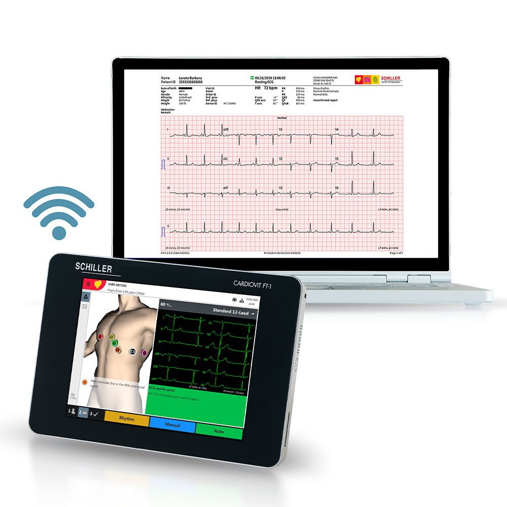 Ruhe-EKG